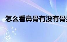 怎么看鼻骨有没有骨折（怎么看鼻梁高低）