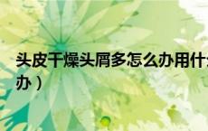 头皮干燥头屑多怎么办用什么洗发水（头皮干燥头屑多怎么办）
