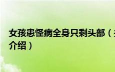 女孩患怪病全身只剩头部（关于女孩患怪病全身只剩头部的介绍）