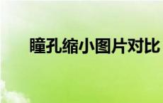 瞳孔缩小图片对比（瞳孔放大对比图）