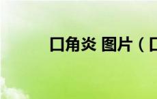 口角炎 图片（口角炎图片症状）