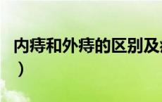 内痔和外痔的区别及症状（内痔和外痔的区别）