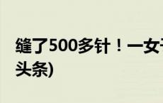 缝了500多针！一女子被狗撕碎左脸！(今日/头条)