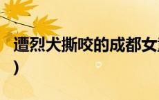 遭烈犬撕咬的成都女童右肾已保住(今日/头条)