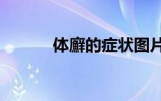 体廯的症状图片（体藓的症状）