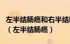 左半结肠癌和右半结肠癌在临床上有什么区别（左半结肠癌）