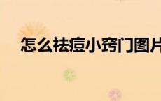 怎么祛痘小窍门图片（怎么祛痘小窍门）