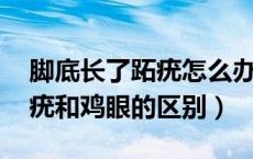 脚底长了跖疣怎么办 跖疣和鸡眼的区别（跖疣和鸡眼的区别）