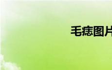毛痣图片（毛痣）