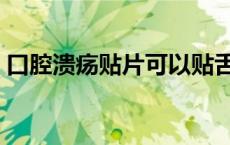 口腔溃疡贴片可以贴舌头吗（口腔溃疡贴片）