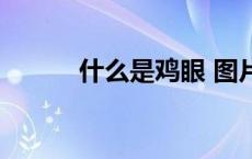 什么是鸡眼 图片（什么是鸡眼）