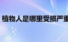 植物人是哪里受损严重（植物人是哪里受损）