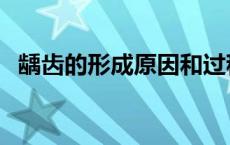 龋齿的形成原因和过程动画（龋齿的形成）