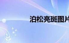 泊松亮斑图片（泊松亮斑）